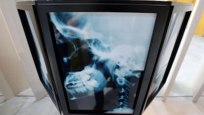 X-Ray machine for Expo 1901 in Buffalo, USA at the visitor centre. Expo 2020 Dubai Open Doors. Chris Whiteoak / The National