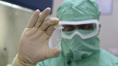 About 30,000 volunteers will receive injections in India next month in final stage trials. Courtesy: Zydus Cadila