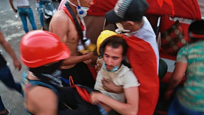 An injured protester is rushed to a hospital in Baghdad. AP Photo