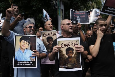 Officials in Gaza say dozens of people have died from starvation and malnutrition. AP