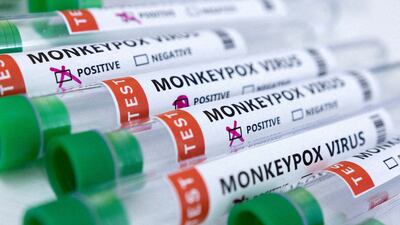 A new consortium will research, among other things, the effectiveness of monkeypox vaccines. Reuters