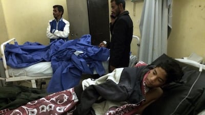 Abdallah Abdel Nasser, 14, was injured in the attack on the mosque in the Sinai Peninsula - the deadliest ever by Islamist extremists in Egypt. He is being treated at Suez Canal University hospital in Ismailia, Egypt. Amr Nabil / AP