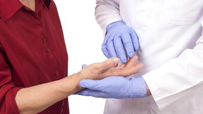 The Middle East Arthritis Foundation will hold a rheumatoid arthritis awareness event on Saturday, February 4, at the Hilton Ras Al Khaimah. Courtesy Middle East Arthritis Foundation