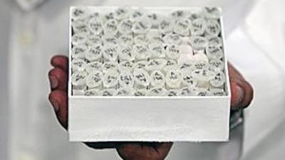 A box of DNA samples at the Dubai Cord Blood & Research Centre in Dubai.