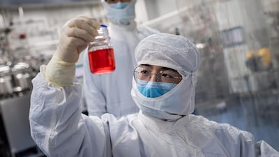 A scientist looks at monkey kidney cells as he make a test on an experimental vaccine for the Covid-19 coronavirus inside the Cells Culture Room laboratory at the Sinovac Biotech facilities in Beijing. AFP