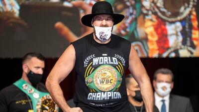 Tyson Fury poses during the weigh-in. AP