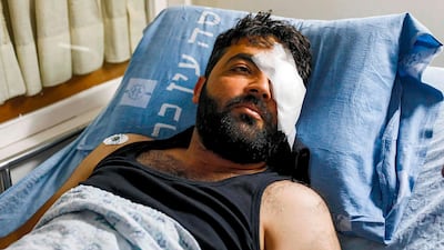 Palestinian cameraman Muath Amarneh lies in a bed at Hadassa Ein Karem hospital in Jerusalem after being shot in his left eye by Israeli soldiers on November 15, 2019. AFP