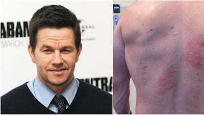 Mark Wahlberg has revealed he is allergic to 'almost everything'. Instagram / Mark Wahlberg