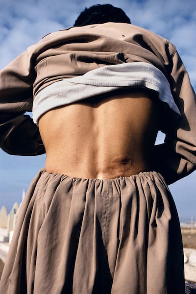 Arbil Taymour Abdullah, 15, the only survivor of a village execution, shows his bullet wound. Susan Meiselas / Magnum Photos