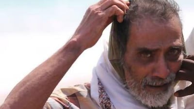 Mohamad Abdalla Ali, a Yemeni sailor, whose ears were slashed by the Somali pirates. He is being given medical care and will need further treatment. Courtesy of Mohamad Abdirahman, PMPF director.