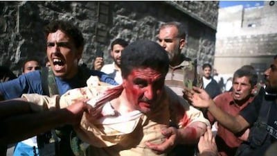 Rebel Free Syrian Army (FSA) fighters capture a policeman who they allege is a pro-regime militiaman in Aleppo. A watchdog said that rebels killed 40 officers and seized three police stations during the battle for the commercial capital.