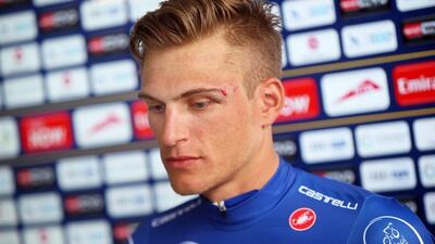Marcel Kittel sports a cut over his left eye from the punch from Andrey Grivko during Stage 3 of the Dubai Tour. Matteo Bazzi / EPA