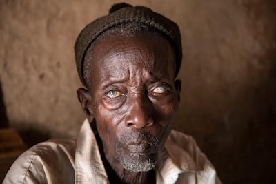 Diba Cisskho, 70, lost his eyesight to river blindness. His translucent eyes are the telltale sign of the disease, which is transmitted by black flies. Courtesy Ed Kashi
