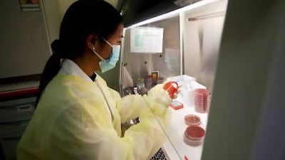 A medical laboratory technician at work in the microbiology lab at Al Noor Hospital in Abu Dhabi. Christopher Pike / The National