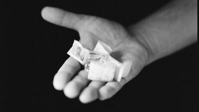 A car salesman holding his prison ID bracelet, as he didn’t want to show his face. He was forced to lie down in excrement. Guards tied a rope around his neck, a leash for dogs made of leather. Chris Bartlett