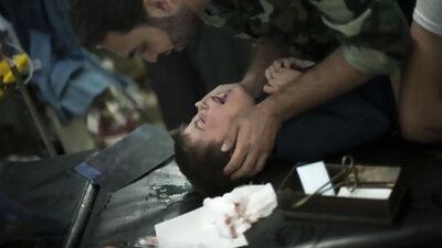 A Free Syrian Army fighter comforts a child wounded by Syrian Army artillery shelling, at Dar El Shifa hospital in Aleppo. Photographs have been taken of Syrian war victims foaming at the mouth and with contracted pupils, which may indicate sarin gas.