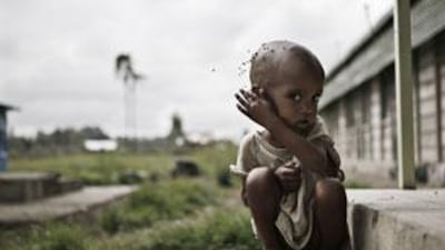 Malnourished children were among the 4.5 million Ethiopians who needed food aid during a drought in the country last year.