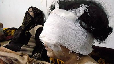 A wounded girl sits beside her mother in the Baba Amro neighbourhood of Homs as Syrian government troops shelled the city for a fourth day.