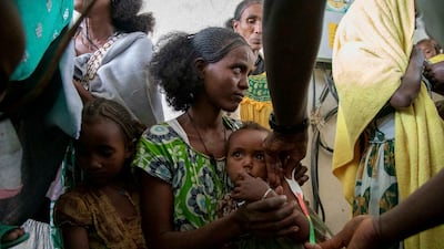 A woman holds a child during a screening for malnutrition by aid groups in the Tigray region of northern Ethiopia. AP