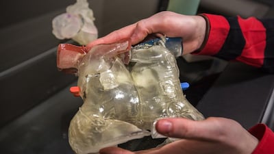 Carolyn Cochenour, holds a model of conjoined twins, created with 3D printing. By combining research and clinical work in this area, the Institute is developing knowledge, tools, and procedures that will benefit children around the world.