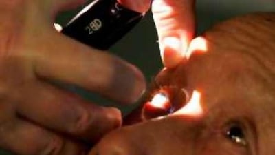 Eye care is covered under national insurance after Moorfields Eye Hospital signs deal with Daman.