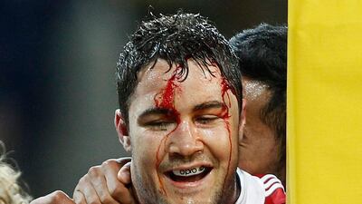 The Lions' Bradley Barritt bleeds from a head injury during the game. Brandon Malone / Reuters