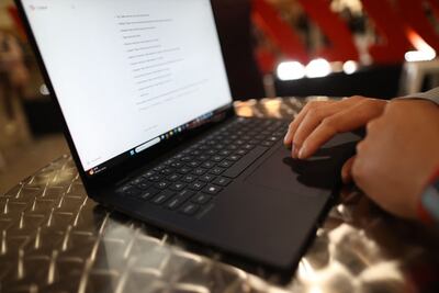 An expert said neurological material could one day be used in everyday consumer electronics. AFP