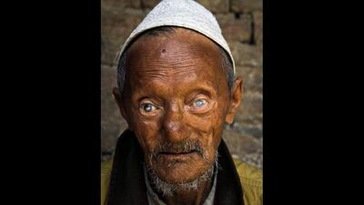 A patient at the hospital poses for a portrait.