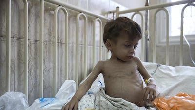 Four-year-old Omar Al Baradee is surrounded by food in his hospital bed to encourage him to eat. He has been to the Naser hospital over 27 times for immune deficiency, now compounded by severe malnourishment. All photos by Heidi Levine for The National