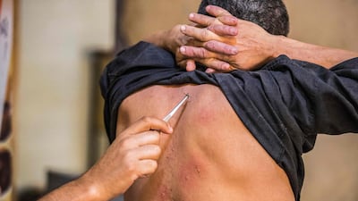 Sayed Al Sayeh trained as an agricultural engineer before practising apitherapy – a branch of traditional medicine that uses honey bee products, ranging from honey to sting venom. AFP