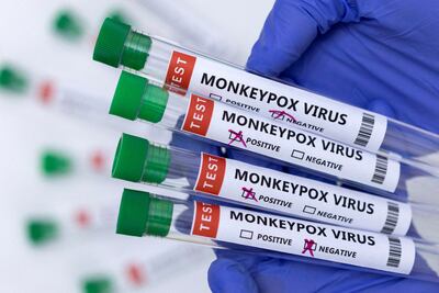 The CDC says the risk of the monkeypox virus remains low but has updated travel advice to Level 2. Reuters / Dado Ruvic