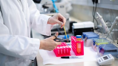 Centres like the CRC had to develop procedures for embryo transfer in camels themselves, as the technique used with horses would not work. Reem Mohammed / The National