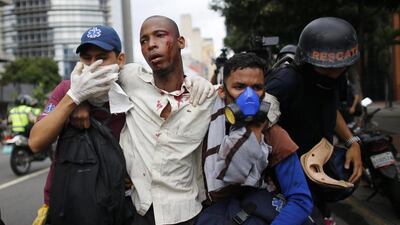 Paramedics assist a man injured during clashes with security forces during protests in Venezuela. Ariana Cubillos / AP Photo