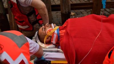 A participant lies on a stretcher after getting hurt during the affray. Alvaro Barrientos / AP Photo