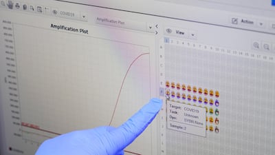 A researcher shows a result of coronavirus-positive case as she demonstrates samples of iLAMP Novel-Coronavirus Detection Kit at an iONEBIO's office in Seongnam, South Korea. Reuters