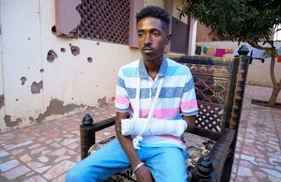A Sudanese resident of Kordofan injured in the fighting. Reuters