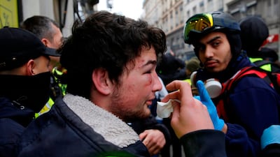 A protester with blood stains on his face treats his injury during an anti-government demonstration called by the "yellow vests" (gilets jaunes) movement. AFP