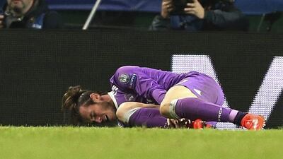 Real Madrid's Gareth Bale reacts after being injured against Sporting Lisbon last week. Steven Governo / AP Photo / November 22, 2016