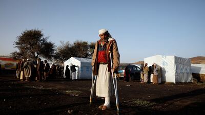 A displaced Yemeni stands at a camp on the outskirts of Sanaa, Yemen. EPA