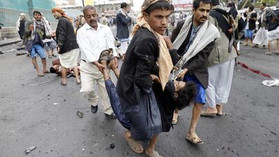 Shiite Houthi rebels carry a wounded man at the scene of the suicide bomb attack in Sanaa on October 9, 2014. At least 67 people were killed. Khaled Abdullah/Reuters