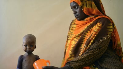 A malnourished child is fed a special formula by her mother at a hospital in Somalia.