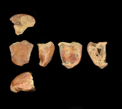 Various views of the incisor tooth that had been spilt. Photo: Dr Emma Pomeroy
