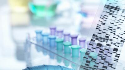 Scientists at the Centre for Arab Genomic Studies in Dubai and Latifa Hospital collaborated on the genetics research project. Getty Images