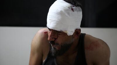 A man who was injured after shells fell on a neighbourhood near Aleppo on January 1. EPA