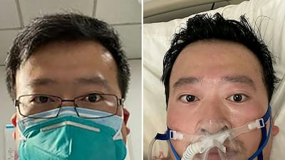 This combination of file pictures shows undated photos obtained on February 7, 2020 of Chinese coronavirus whistleblowing doctor Li Wenliang whose death was confirmed on February 7 at the Wuhan Central Hospital in Wuhan, China's central Hubei province. .AFP PHOTO