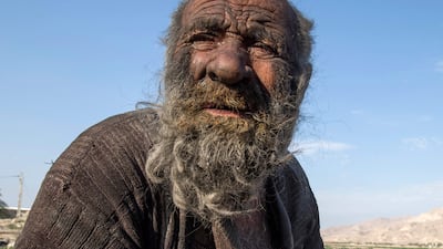 (FILES) In this file photo taken on December 28, 2018 Amou Haji (uncle Haji) sits on the outskirts of the village of Dezhgah in the Dehram district of the southwestern Iranian Fars province. - An Iranian dubbed the "dirtiest man in the world" for not taking a shower for decades has died at the age of 94, state media said on October 25, 2022. (Photo by AFP)