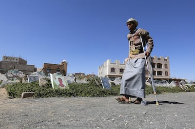 A Yemeni man uses crutches to walk past portraits on the graves of members of Houthi militia allegedly killed in ongoing fighting, at a cemetery in Sana'a, Yemen, 21 December 2018. EPA
