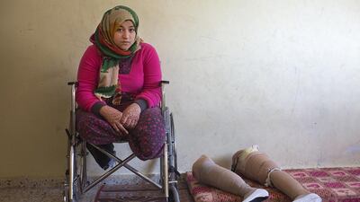 Palestinian Manar Shabari sits in her wheel chair by her prosthetic legs that have been fitted with festive shoes to be worn at her brother’s wedding at a relative’s home in Jabalya, Gaza December ,30,2014 . Manar Shabari,14, suffered severe injuries on July 24 during an Israeli military assault on the UN school in Beit Hanoun, in northern Gaza .Her mother and brother and three other family members were amongst the more than 15 killed at the school where hundreds of displaced civilians were taking shelter during the war between Israel and Palestinian militants in the Hamas-controlled Gaza Strip . Heidi Levine for The National