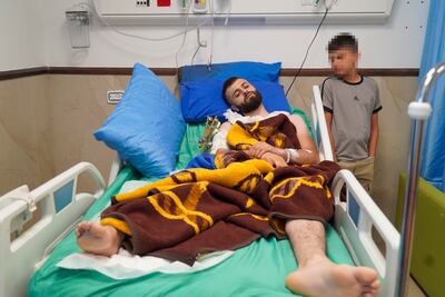 Mujahed Abbadeh, who the Israeli military strapped to the front of a military vehicle, in the Ibn Sina Specialised Hospital in Jenin. Willy Lowry / The National