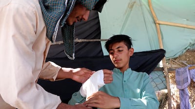 A young Afghan receives medical care after being injured in fighting between the Taliban and security forces in Mazar-e-Sharif. AP